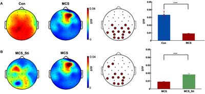 Electroencephalography and Functional Magnetic Resonance Imaging-Guided Simultaneous Transcranial Direct Current Stimulation and Repetitive Transcranial Magnetic Stimulation in a Patient With Minimally Conscious State